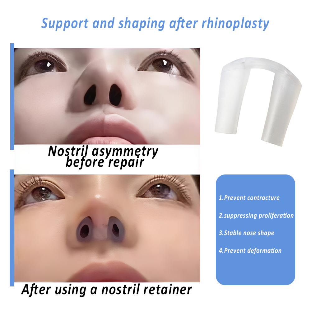 Nasenlochhalter für die Nach-N – Anti Snore Contour Pillow Bewertung und Preis